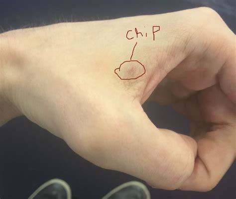 rfid chip implant youtube|I got a computer chip implanted into my hand. Here's .